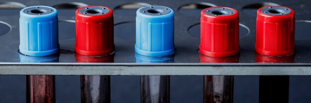 Jakie korzyści niesie zastosowanie wkładów kominowych ocynkowanych i kwasoodpornych?